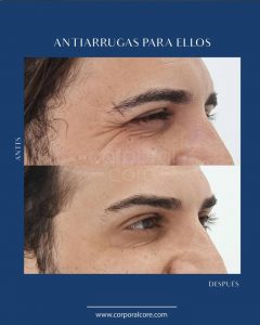 tratamiento neuromoduladores 4